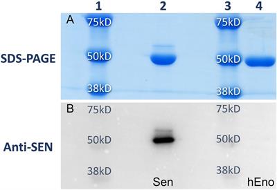 Relationships Between Plasminogen-Binding M-Protein and Surface Enolase for Human Plasminogen Acquisition and Activation in Streptococcus pyogenes